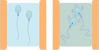 頸管因子における精子のイメージ
