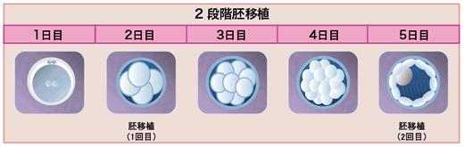 2段階胚移植