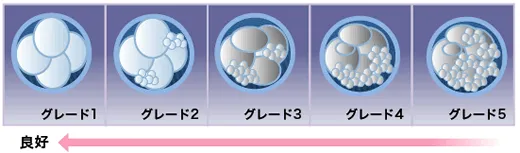 初期胚のグレード1～5までのイメージ