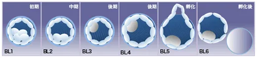 胚盤胞のグレードBL1～BL6までのイメージ